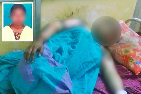 TN woman who burnt self after police inaction against harasser succumbs to injuries  
