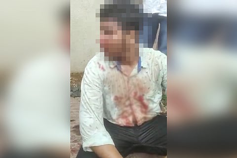 Boy hit for wearing skull cap in Bagalkot district of Karnataka