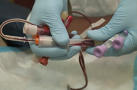 Nine-year-old cancer patient contracts HIV, parents blame blood transfusion at Kerala hospital