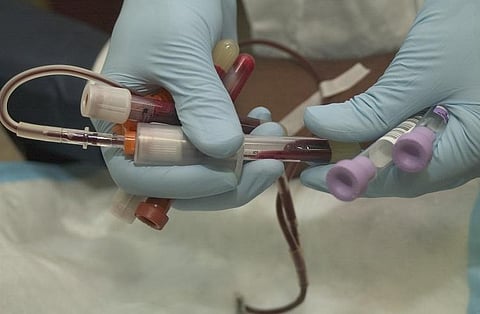 Three people hospitalised with anthrax symptoms in Anantapur GGH in Andhra