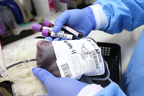 Representative image of blood transfusion: Hyderabad blood bank booked as 3-yr-old tests HIV positive after transfusion 