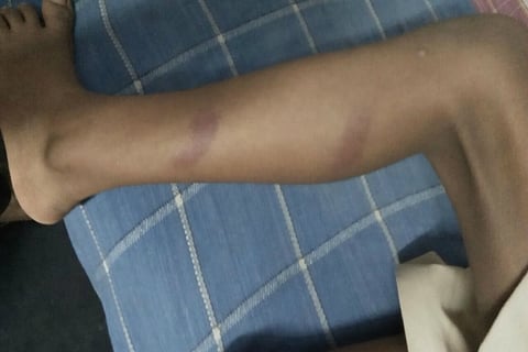 Class 3 student beaten up in Andhra, school issues TC to him and sibling when questioned