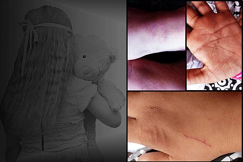 Locked up, tied and beaten: Girl with intellectual disability allegedly abused in Kerala school