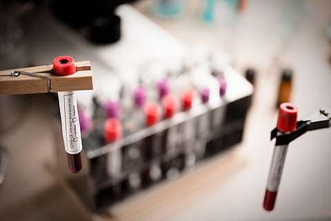 Coronavirus testing samples