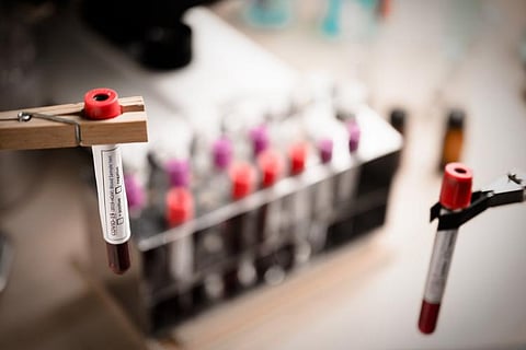 Jubilant Life Sciences to make drug Remdesivir, firm was in news after employees got COVID-19
