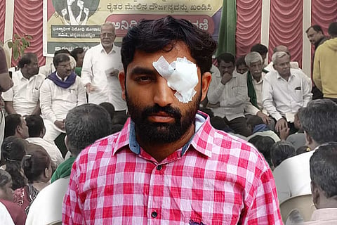 Bengaluru: Farmer loses his eyesight after police brutality at Devanahalli 
