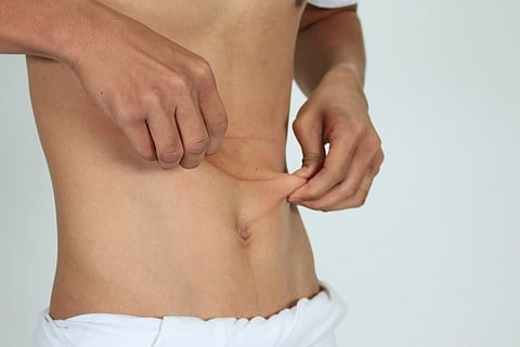 Good health is a good feeling in the gut: How intestinal transplants are saving lives   