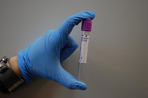 World's first Zika virus vaccine? Indian scientists claim to have made it