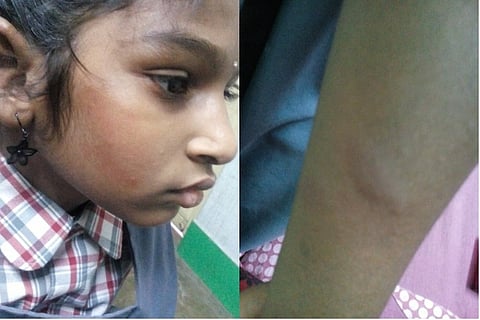 9-year-old student in Hyd beaten for not plaiting her hair, police complaint filed
