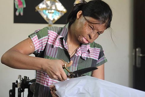 They stole her face, but her dreams are intact... Rupa an acid attack survivor becomes dress designer