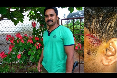 Case filed against cop who assaulted helmetless rider in Kollam