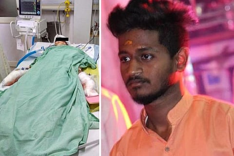 Hyderabad stalker victim undergoes 7-hour surgery, docs worried about infection