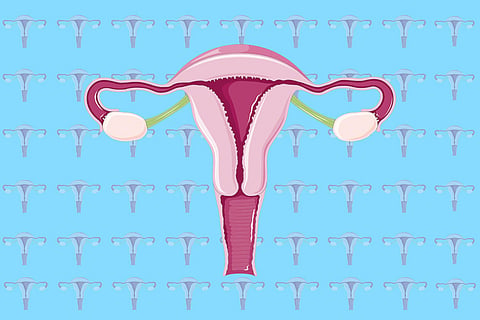 The effect of PCOS on women’s fertility, periods, weight gain and more, explained