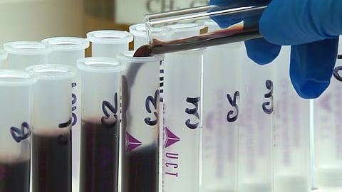 Blood test 