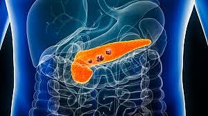 Pancreatic cancer in young women under 25 skyrockets 200% in UK