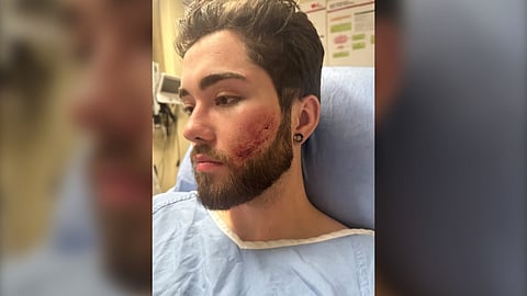 Spencer Weilermann, 23, claimed he was attacked by a cougar on February 12.