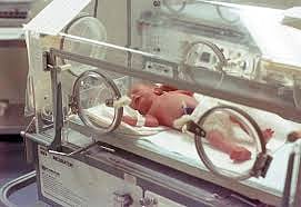 A premature infant in an incubator 