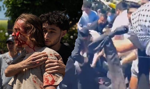 Violent street fight between Palestine, Israel protesters at LA synagogue