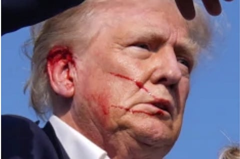 Shot President Trump