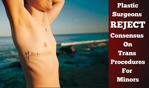 American Society of Plastic Surgeons rejects consensus on transitioning minors