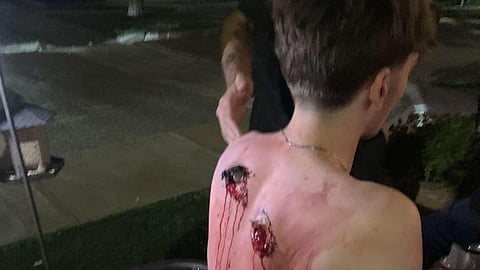 A 17-year-old boy suffered from bullet wounds after being shot at in St. Albert. 