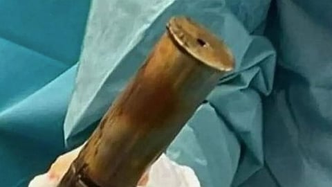 French hospital evacuated after patient turns up with World War One artillery shell lodged in rectum