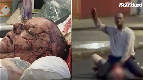 Victim identified from the Belfast "beheading" attempt