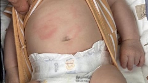 Calgary police seek witnesses after baby struck by boy on scooter

