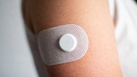 Continuous Glucose Monitor (CGM) sensor.
