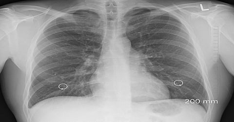 BC business owner knowingly exposed unsuspecting workers to asbestos