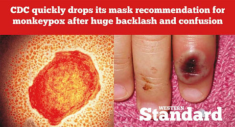 CDC quickly drops monkeypox mask recommendation after huge backlash