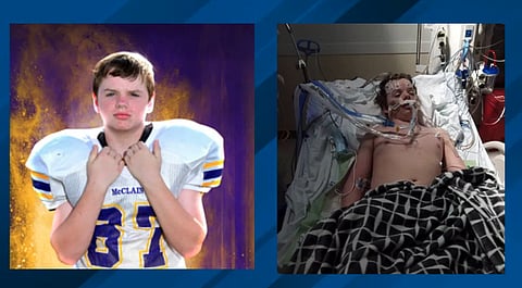 Teenage boy dies after taking TikTok challenge