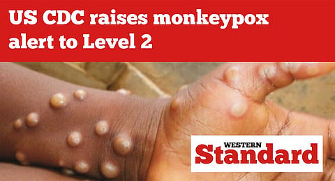 US CDC raises monkeypox alert to Level 2