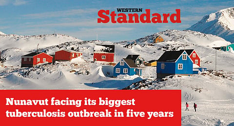 Nunavut facing its biggest tuberculosis outbreak in five years