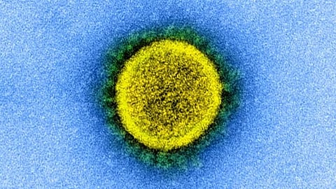 A transmission electron micrograph of COVID-19 isolated from a patient.