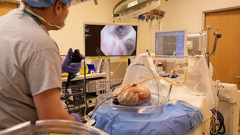 MPs vote to ban organ trafficking in Canada