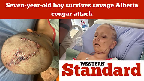 Seven-year-old boy survives savage Alberta cougar attack