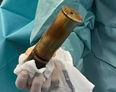 THAT'S A BUMMER: 88-year-old Frenchman hospitalized after shell lodged in rear end