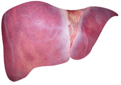 Canadian Liver Foundation launch petition, non-alcoholic fatty liver disease cases increasing