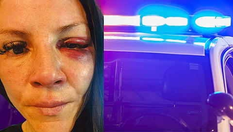 Police union blasts Red Deer lawyer for  publicly shaming officer after brutality claims