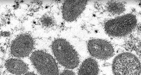 Studies find monkeypox spread mainly driven by men who have sex with men