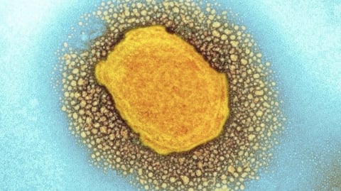 More than 1,000 cases of monkeypox reported in Canada, with 99% of them in men