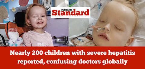Nearly 200 children with severe hepatitis reported, confusing doctors globally