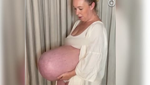 BABY DOME: Mom's horizontal baby bump births internet shock