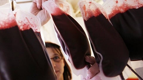 CLEMENT: Banning paid blood donations only forces us to pay for foreign donations