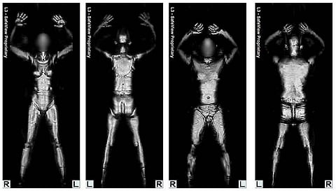 Body scanners