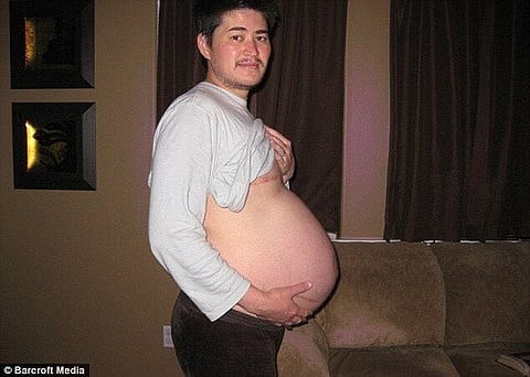 UK midwife students taught to care for men giving birth ‘through their penis’