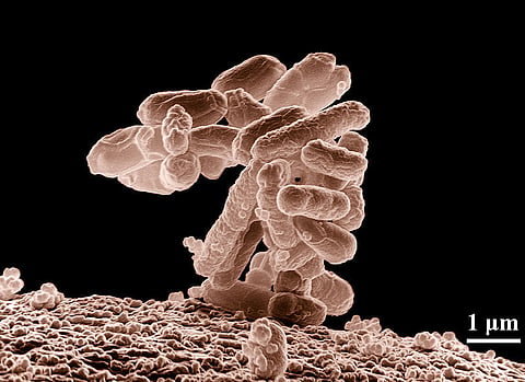 Dozens of E. coli cases at Calgary daycare centres, 15 kids in hospital