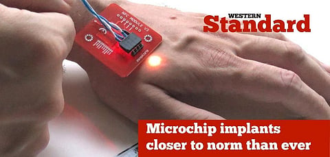 Microchip implants closer to norm than ever